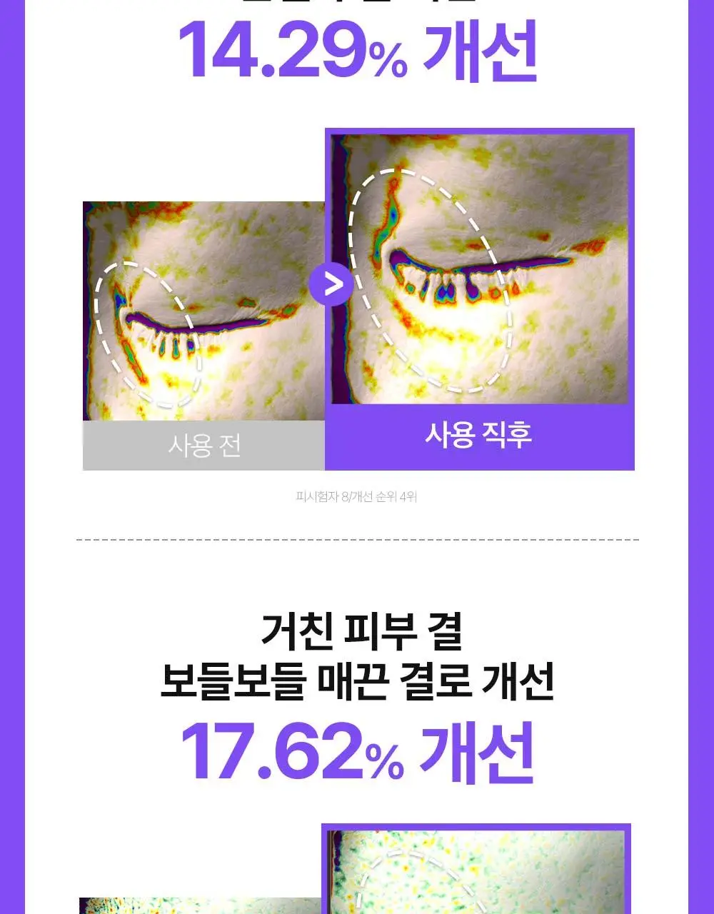 [나띠PICK][잡티케어] 더마펌 수딩 리페어 토닝 세럼 R4 30ml 기획 (+리필 30ml) 상세페이지 28